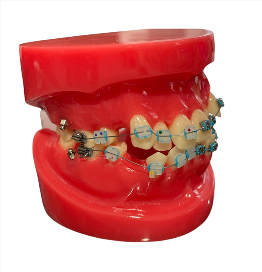 Typodont with Orthodontics